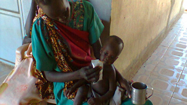 栄養治療食で食欲テストを受ける栄養不良の子ども（南スーダン）©Word Vision